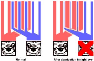 Layout of V1 in normal and monocularly deprived individuals
