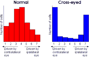 Ocular dominance histograms for normal and monocularly deprived individuals